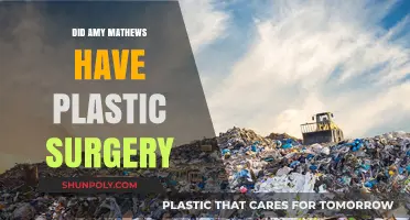 Amy Mathews Plastic Surgery: Fact-Checking the Rumors and Speculations