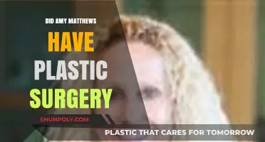 Amy Matthews Plastic Surgery: Fact-Checking the Rumors and Speculations