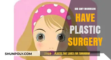 Amy Morrison's Transformation: Plastic Surgery Speculations and Truths Revealed