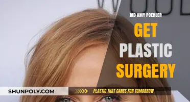 Amy Poehler's Transformation: Plastic Surgery Rumors Explored and Debunked