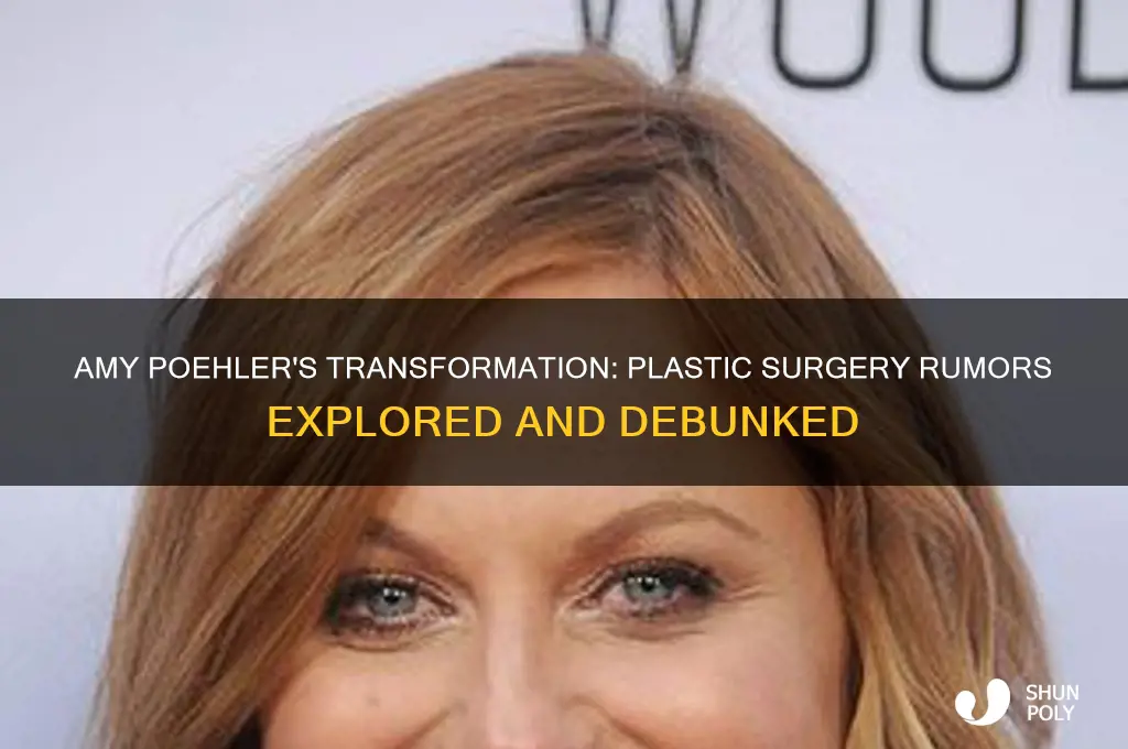 did amy poehler get plastic surgery