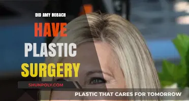 Amy Robach's Transformation: Plastic Surgery Speculations and Truths Revealed