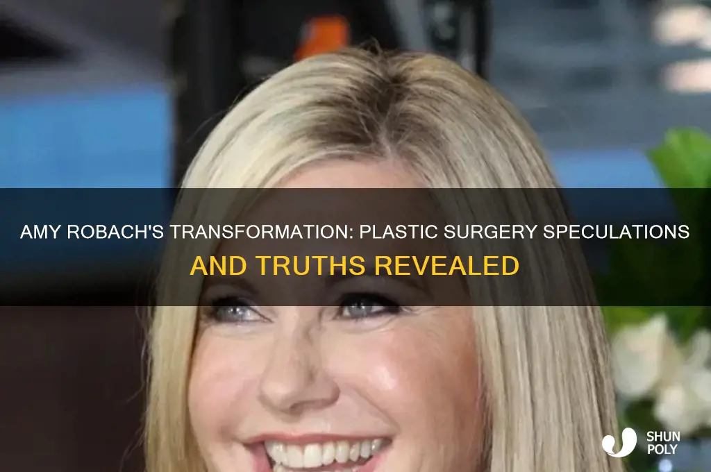 did amy robach have plastic surgery