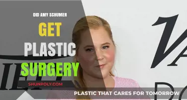 Amy Schumer's Transformation: Plastic Surgery Rumors and Reality Revealed