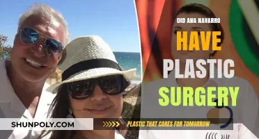 Ana Navarro Plastic Surgery: Fact-Checking the Rumors and Speculations