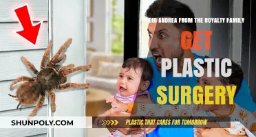 Andrea's Transformation: Plastic Surgery Rumors in The Royalty Family