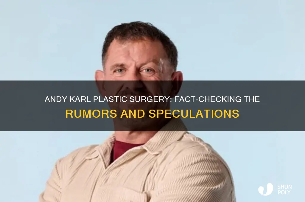 did andy karl have plastic surgery