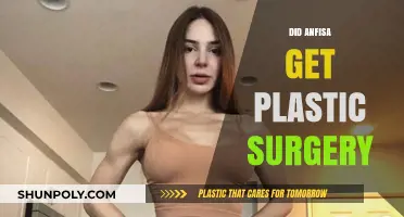 Did Anfisa Undergo Plastic Surgery? Unveiling the Truth Behind Her Transformation