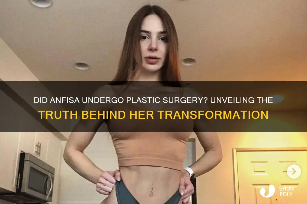 did anfisa get plastic surgery