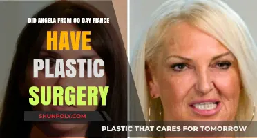 Angela's Transformation: Plastic Surgery Rumors on 90 Day Fiancé Explored