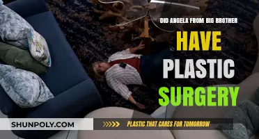 Angela Big Brother Plastic Surgery: Fact-Checking the Transformation Rumors