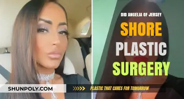 Angelina Jersey Shore Plastic Surgery: Fact-Checking the Transformation Rumors