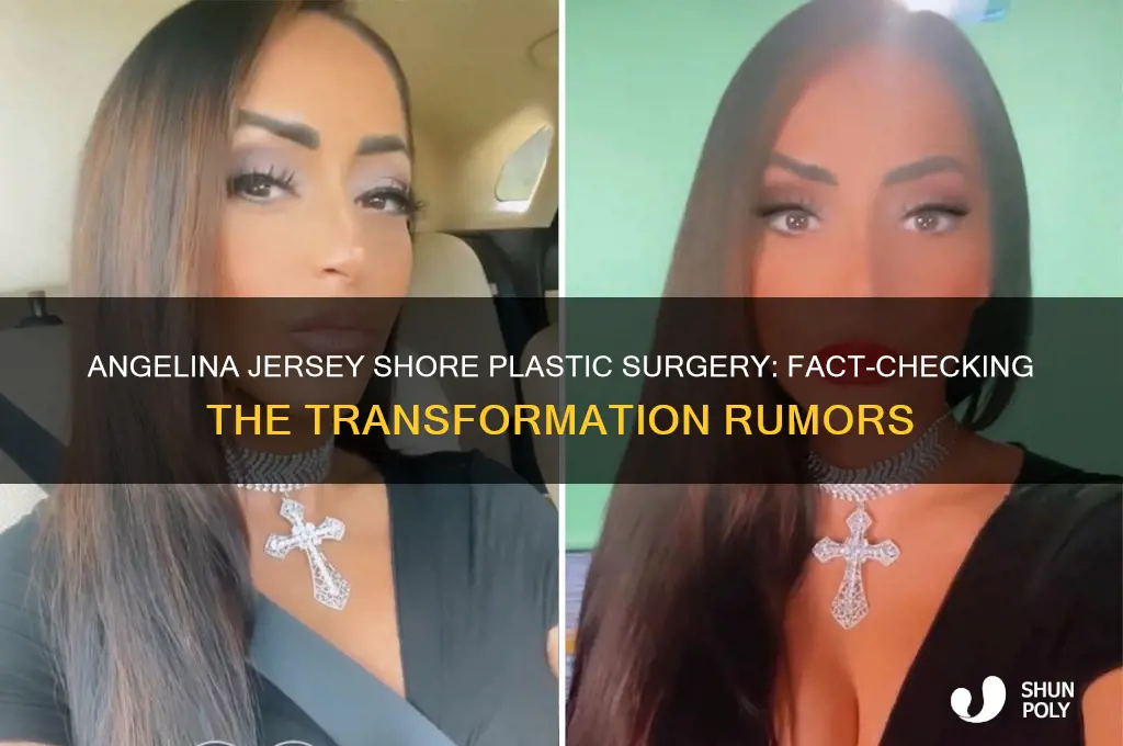 did angelia of jersey shore plastic surgery