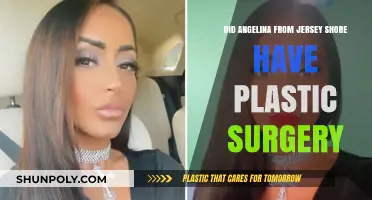 Angelina Jersey Shore Plastic Surgery: Fact-Checking Her Transformation