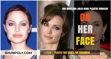 Angelina Jolie's Facial Transformation: Natural Aging or Plastic Surgery?
