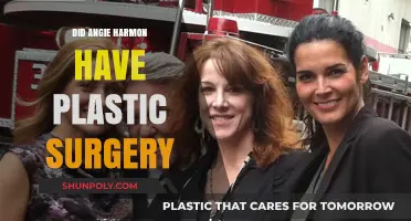 Angie Harmon's Transformation: Plastic Surgery Rumors Explored and Debunked