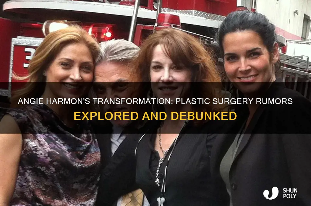 did angie harmon have plastic surgery