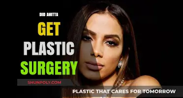 Anitta's Transformation: Plastic Surgery Rumors and the Truth Behind Them