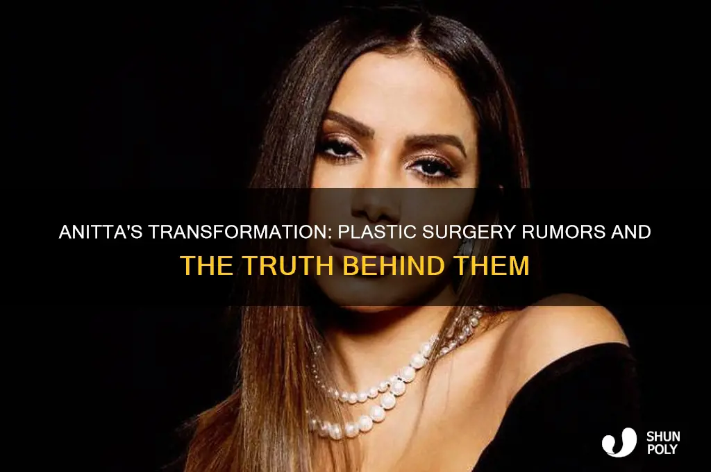 did anitta get plastic surgery