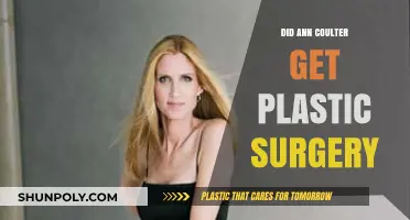 Ann Coulter's Transformation: Plastic Surgery Rumors Explored and Debunked