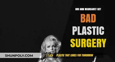 Ann-Margret's Plastic Surgery: Unveiling the Truth Behind Her Changed Appearance