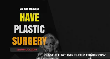 Ann-Margret's Transformation: Plastic Surgery Rumors and Reality Revealed