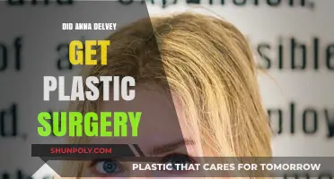 Anna Delvey's Transformation: Plastic Surgery Rumors and Reality Revealed