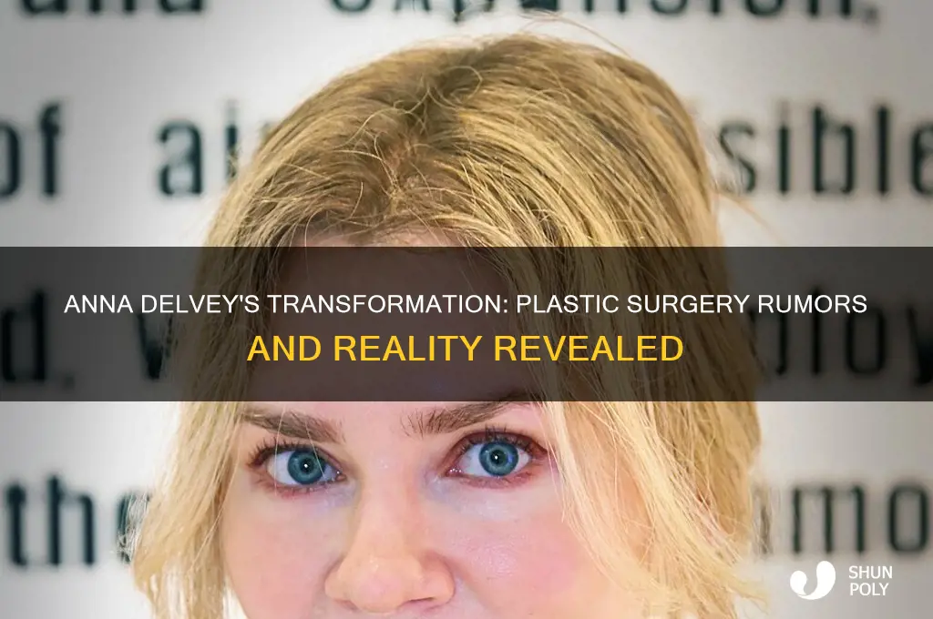 did anna delvey get plastic surgery