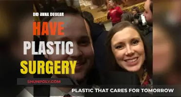 Anna Duggar Plastic Surgery Rumors: Fact or Fiction?