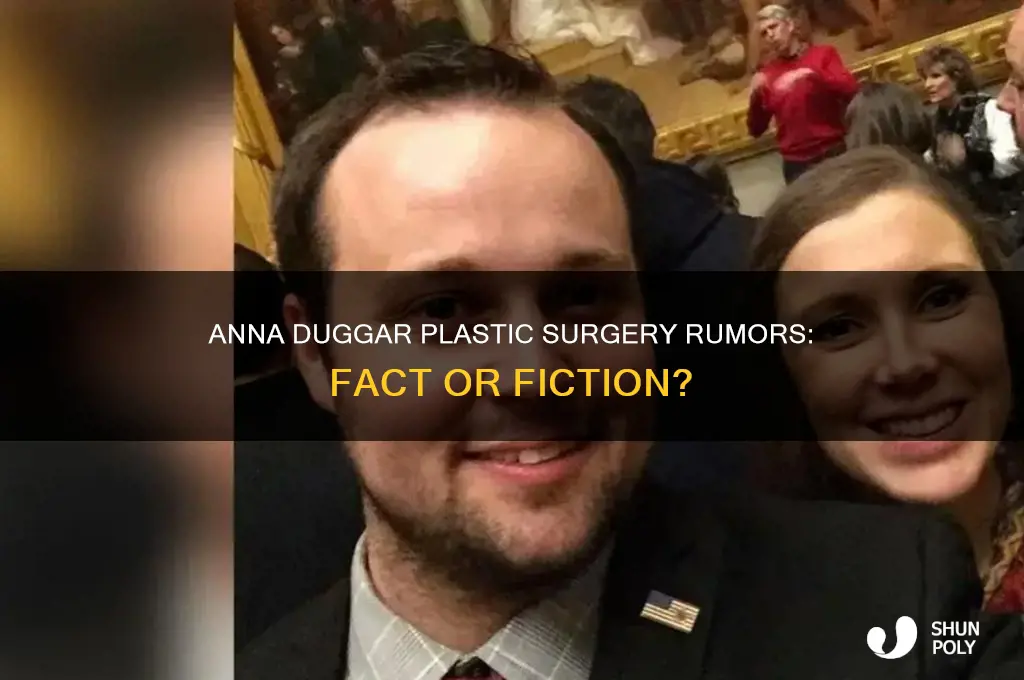 did anna duggar have plastic surgery