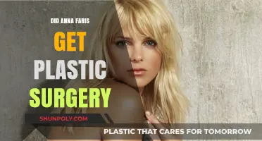 Anna Faris Plastic Surgery: Fact-Checking the Rumors and Speculations