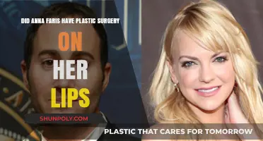 Anna Faris Lip Transformation: Plastic Surgery Speculations Explored