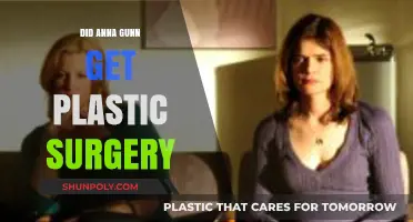Anna Gunn Plastic Surgery: Fact-Checking the Rumors and Speculations