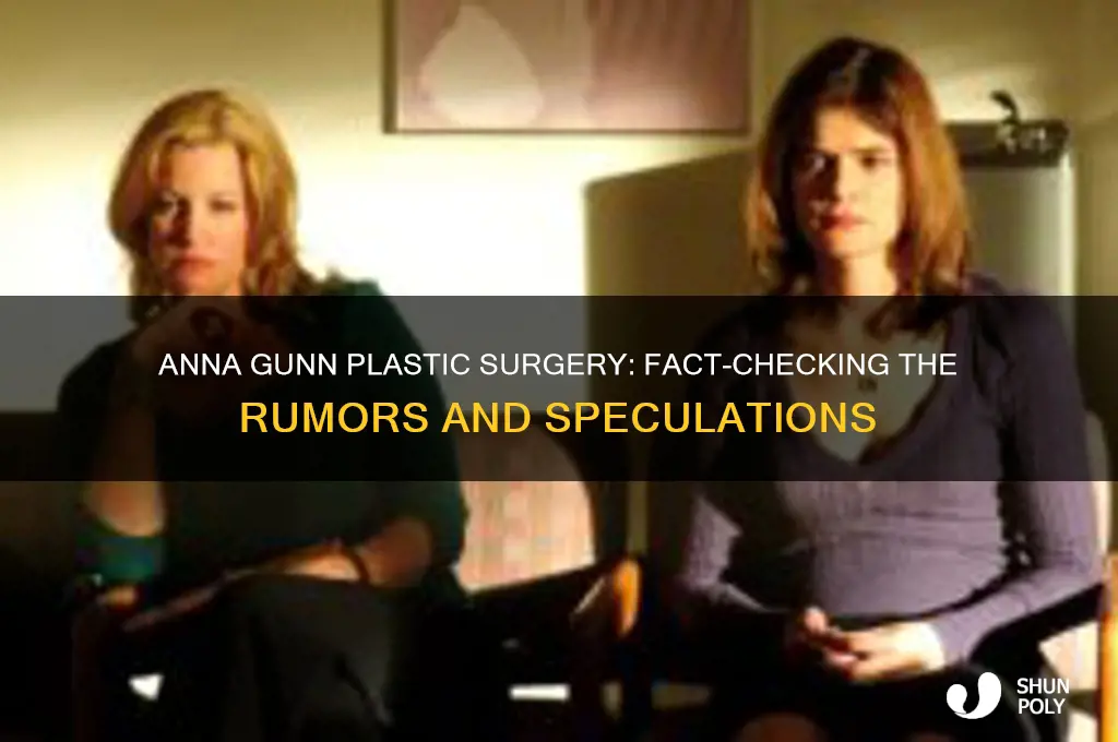 did anna gunn get plastic surgery