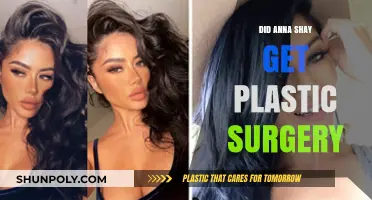 Anna Shay's Transformation: Plastic Surgery Speculations and Truths Revealed