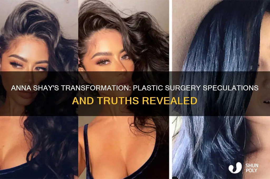 did anna shay get plastic surgery