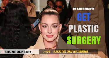 Anne Hathaway Plastic Surgery: Fact or Fiction? Unveiling the Truth