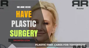 Anne Heche's Transformation: Plastic Surgery Speculations and Truths Revealed