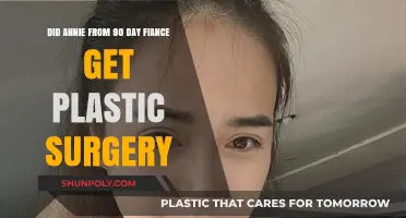 Annie's Transformation: Plastic Surgery Rumors on 90 Day Fiancé Explored