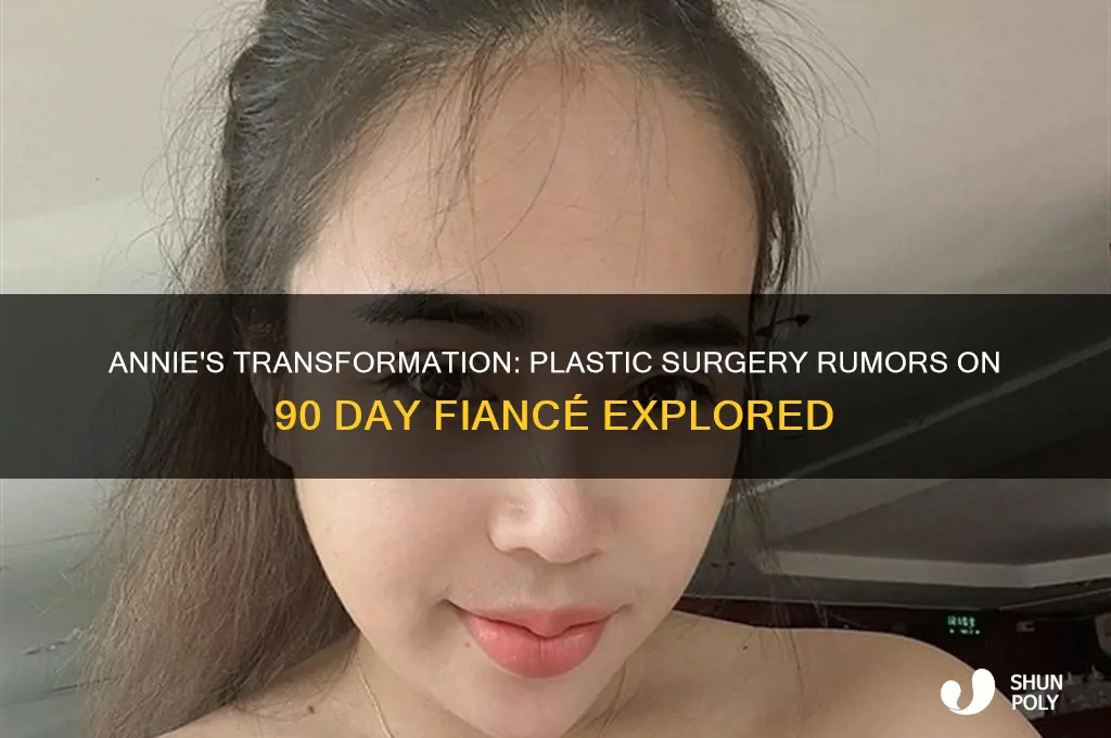 did annie from 90 day fiance get plastic surgery