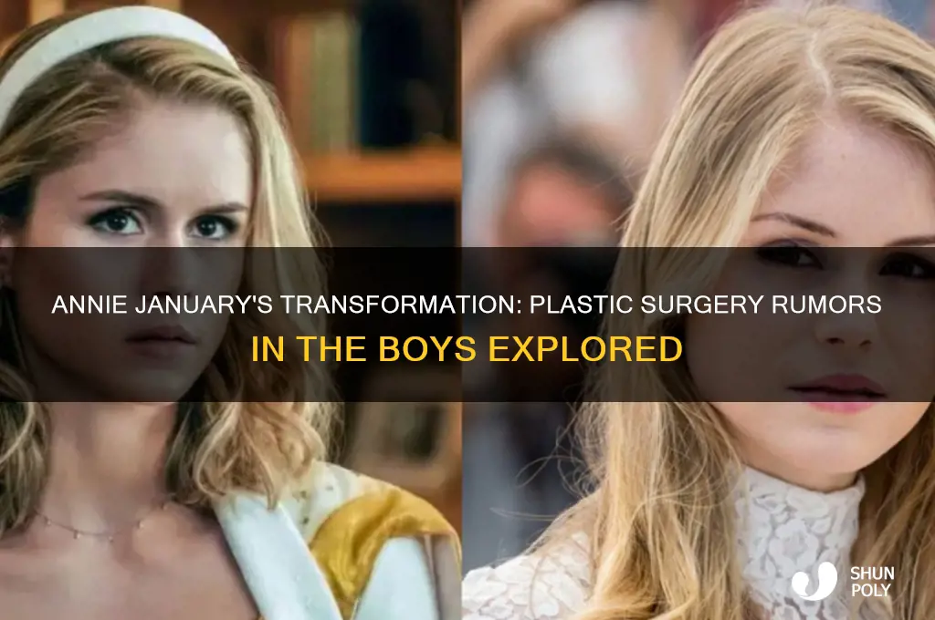 did annie from the boys get plastic surgery