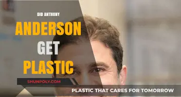 Anthony Anderson Plastic Surgery: Fact-Checking the Rumors and Speculations