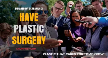 Anthony Scaramucci Plastic Surgery: Fact-Checking the Transformation Rumors