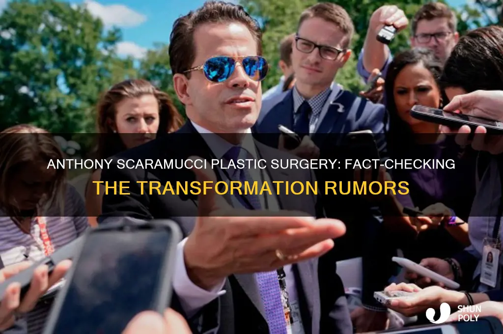 did anthony scaramucci have plastic surgery