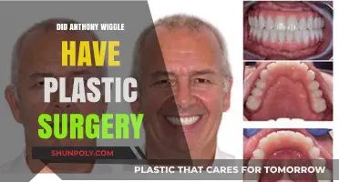 Anthony Wiggle's Transformation: Plastic Surgery Speculations Explored