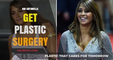 Antonella's Transformation: Plastic Surgery Rumors and the Truth Behind Them