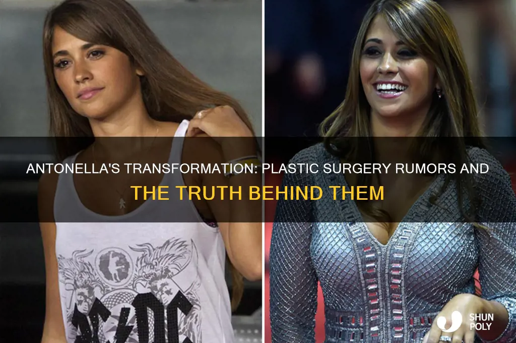 did antonella get plastic surgery