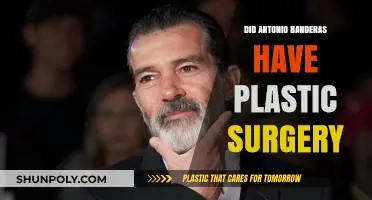 Antonio Banderas Plastic Surgery: Fact-Checking the Rumors and Speculations