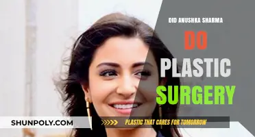 Anushka Sharma Plastic Surgery: Fact-Checking the Rumors and Speculations