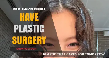 Blackpink Members and Plastic Surgery: Fact-Checking the Rumors